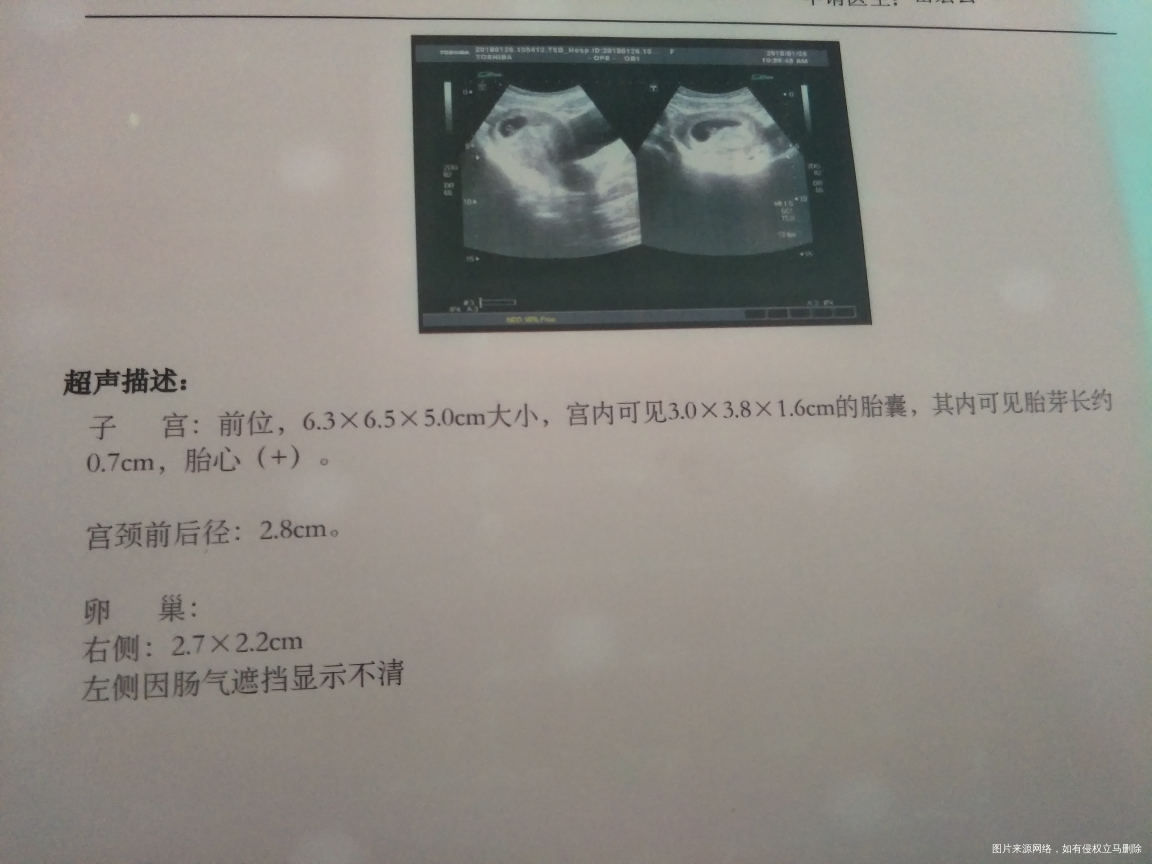 还愿啦,满满正能量!谁接谁中