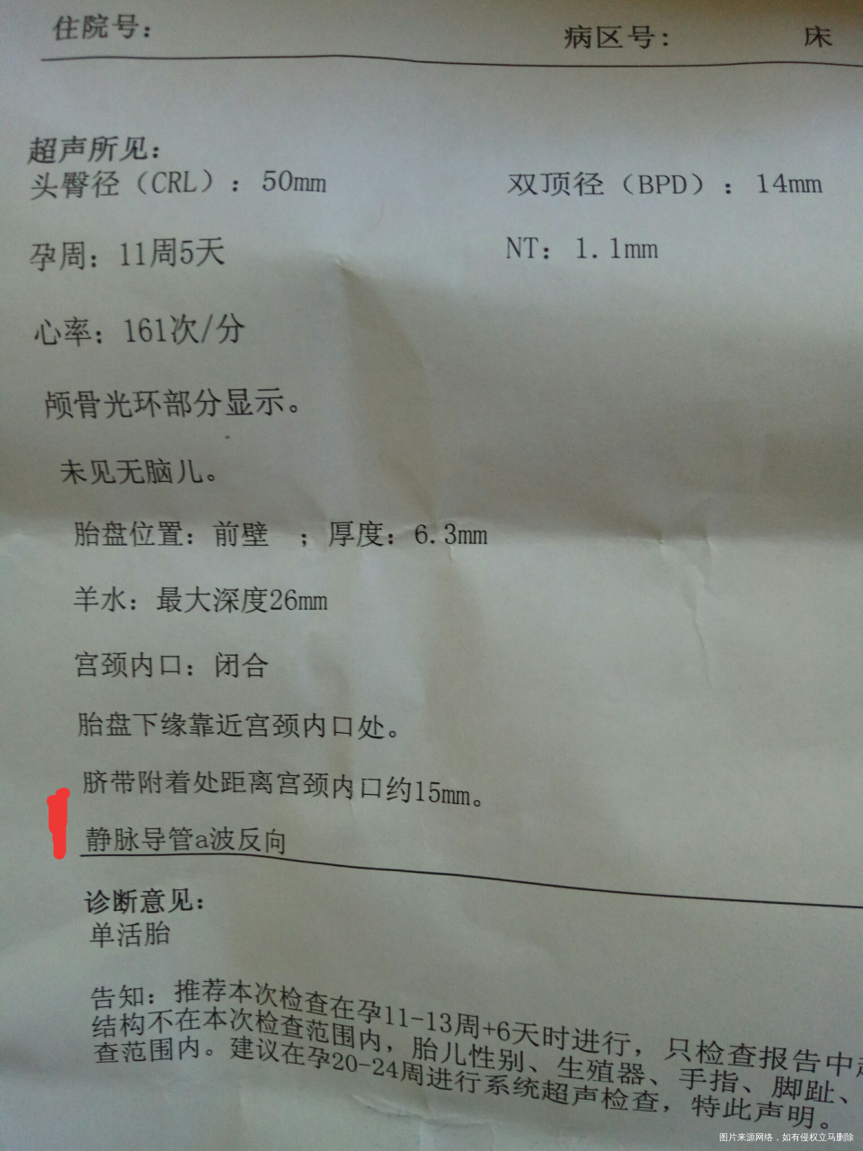 NT结果有点异常,麻烦医生帮忙看下!!