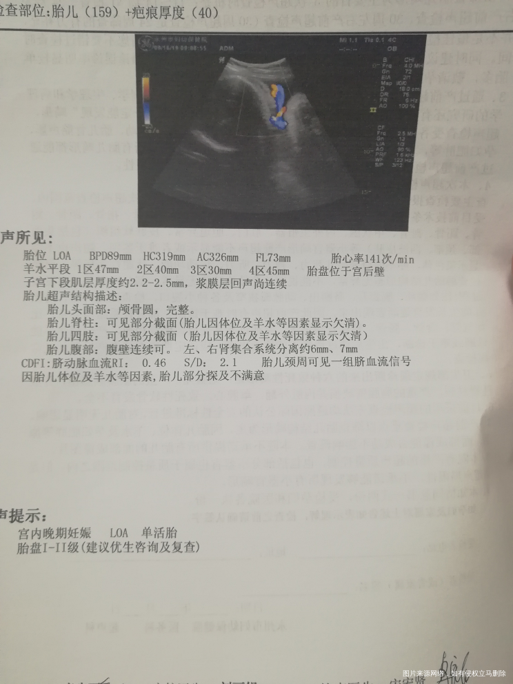 医生帮忙看看,宝宝有多重啊