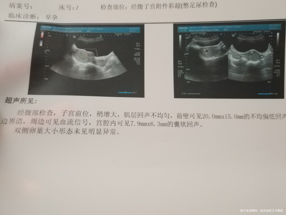 麻烦医生帮我看一下,可见流血信号,怎么回事。