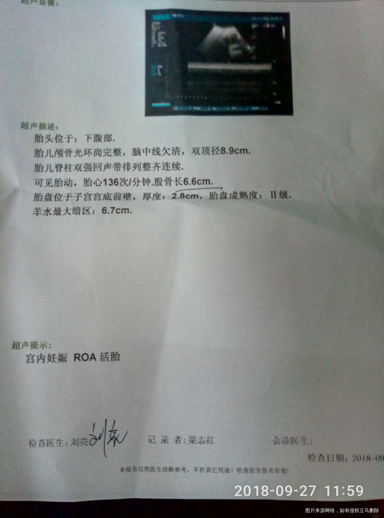 问一下这个是不是快要生了