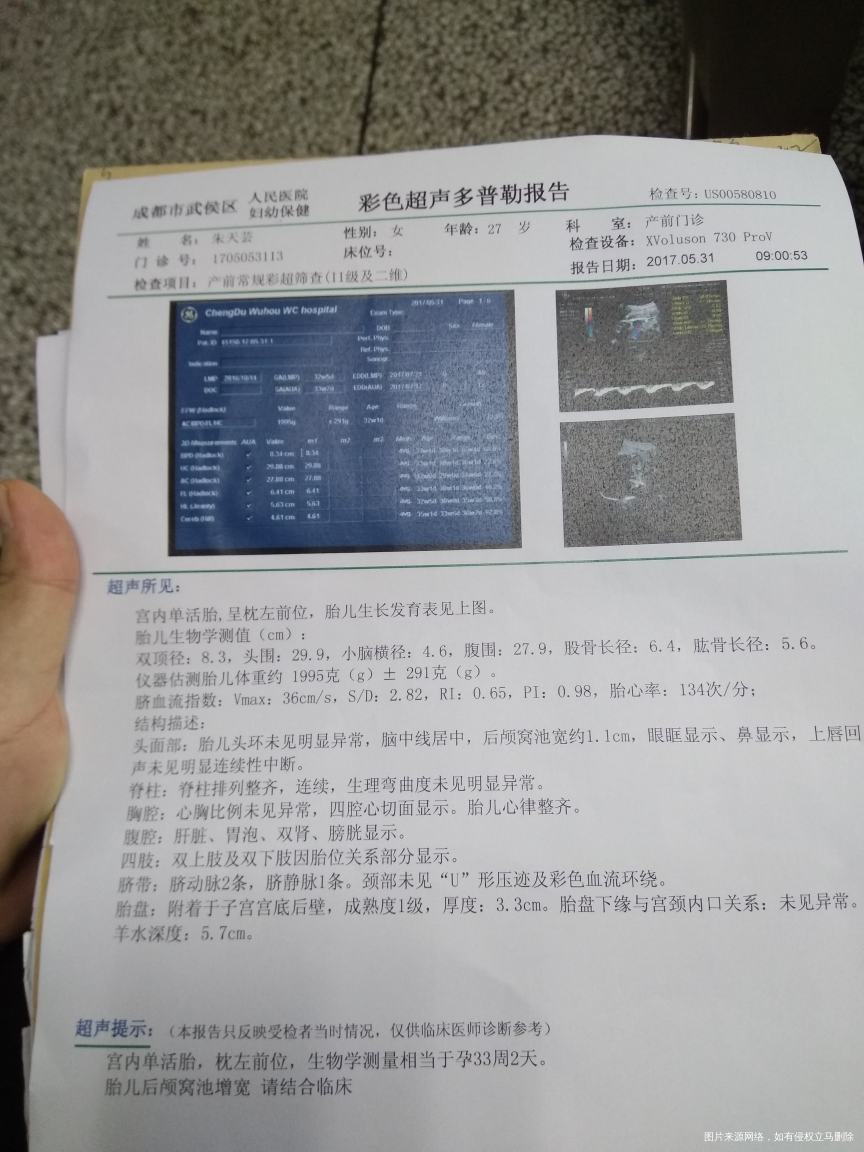 有在线的医生吗,帮忙看看今天产检B超单