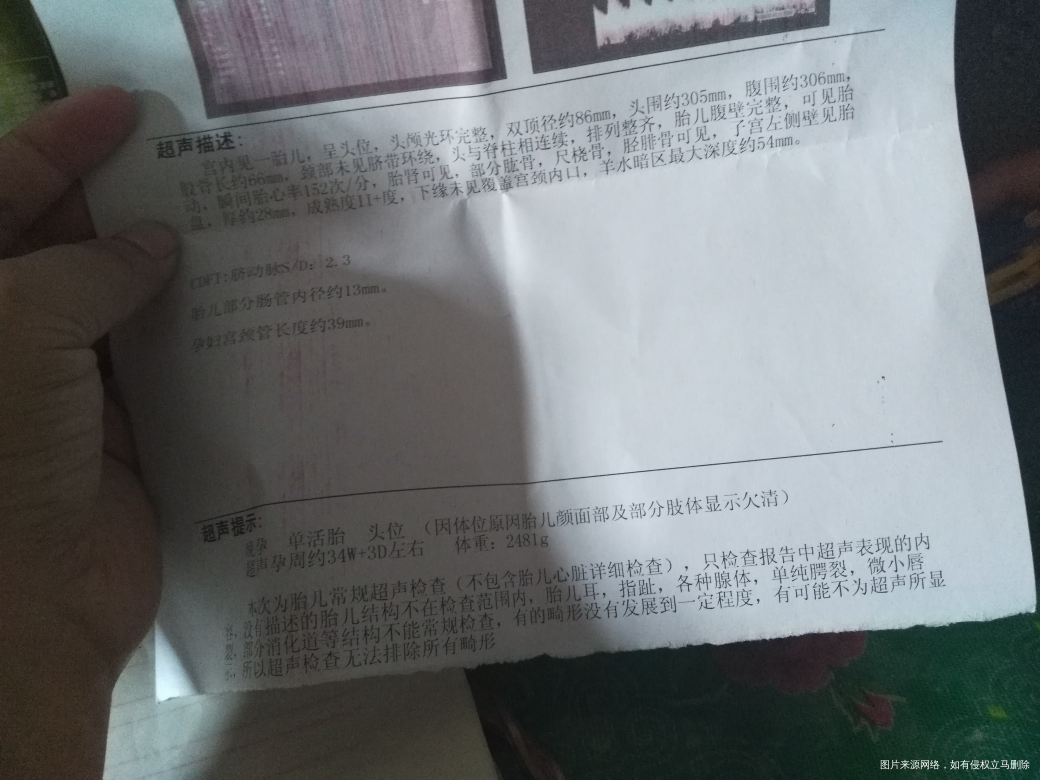 医生帮忙看看检查结果正常吗?