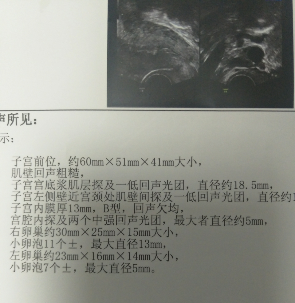 息肉，肌瘤，同床时间，备孕三个月