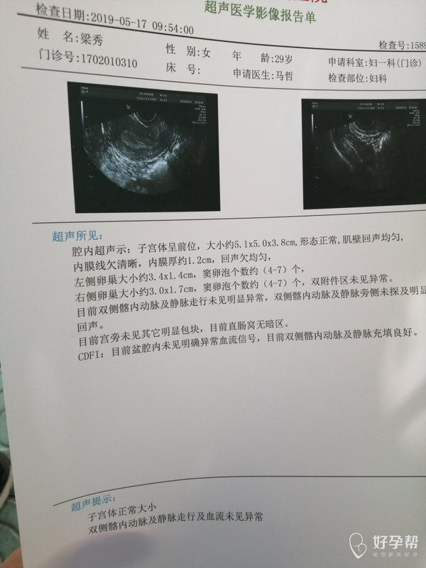 彻底没希望了 已确认流产了