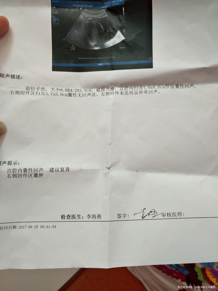 帮我看看是不是怀孕了?