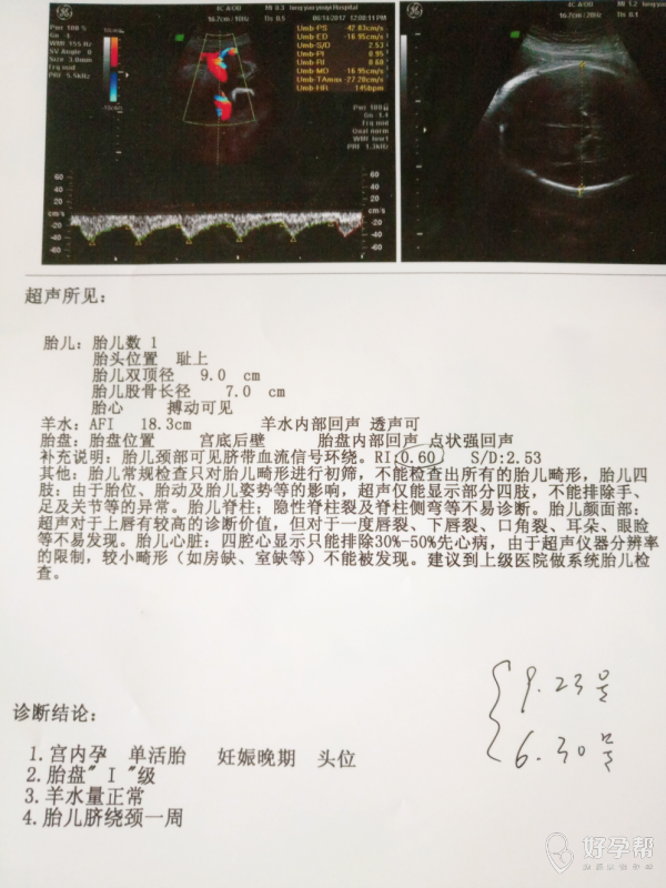 孕37周 5天了今天做b超医生说胎儿偏小怎么办