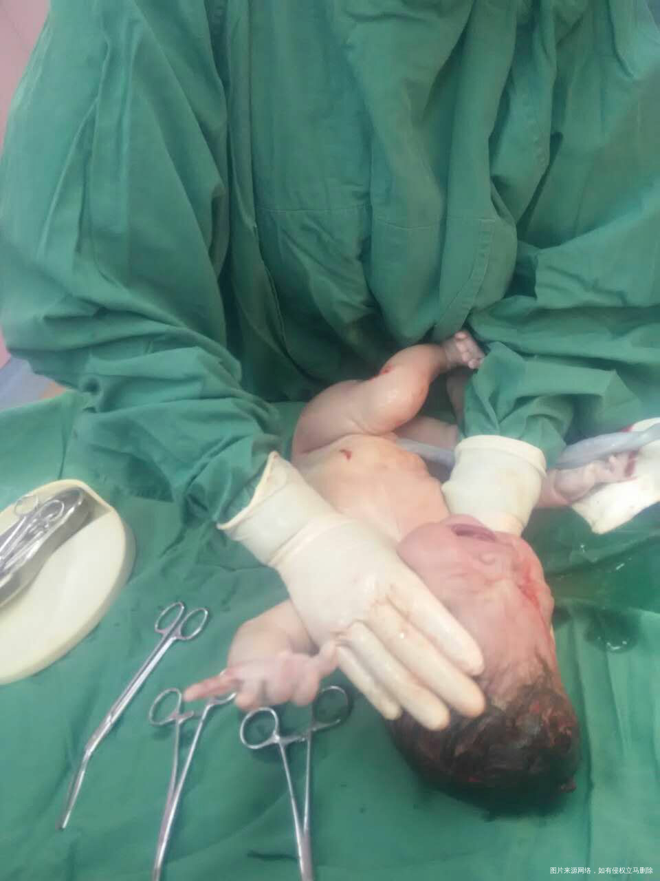 记录一下生产经历2.16