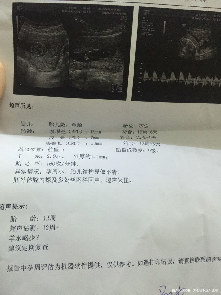 刚做的nt,求助帮忙看一下情况