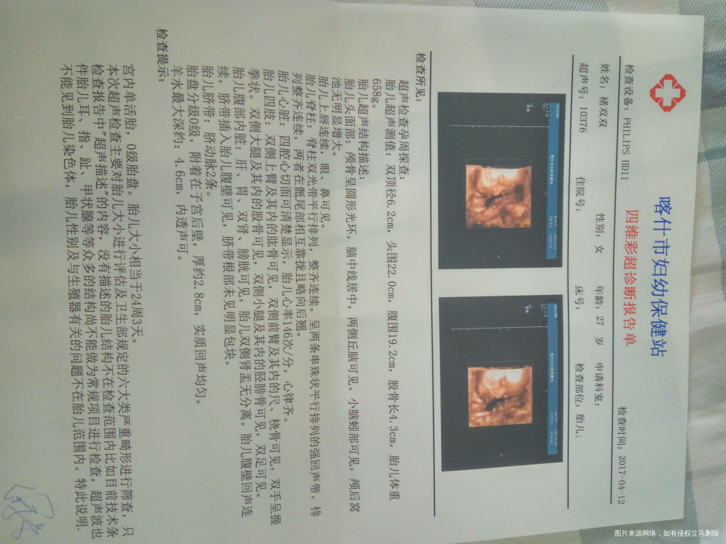 分享自己的顺产经历: 我被医生夸是顺产孕妇的好榜样!