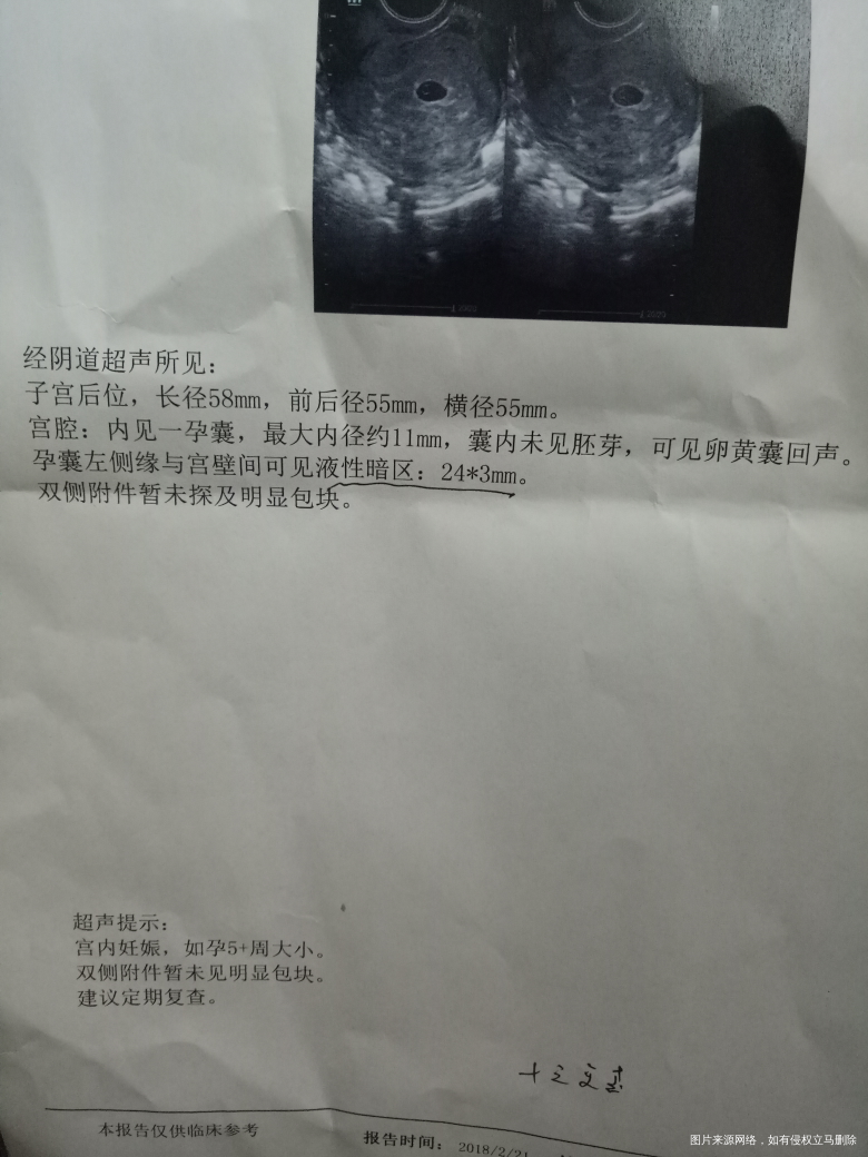 急急急,有在线医生吗?今天去检查,医生说可能会流产?帮我看看吧!谢谢!!