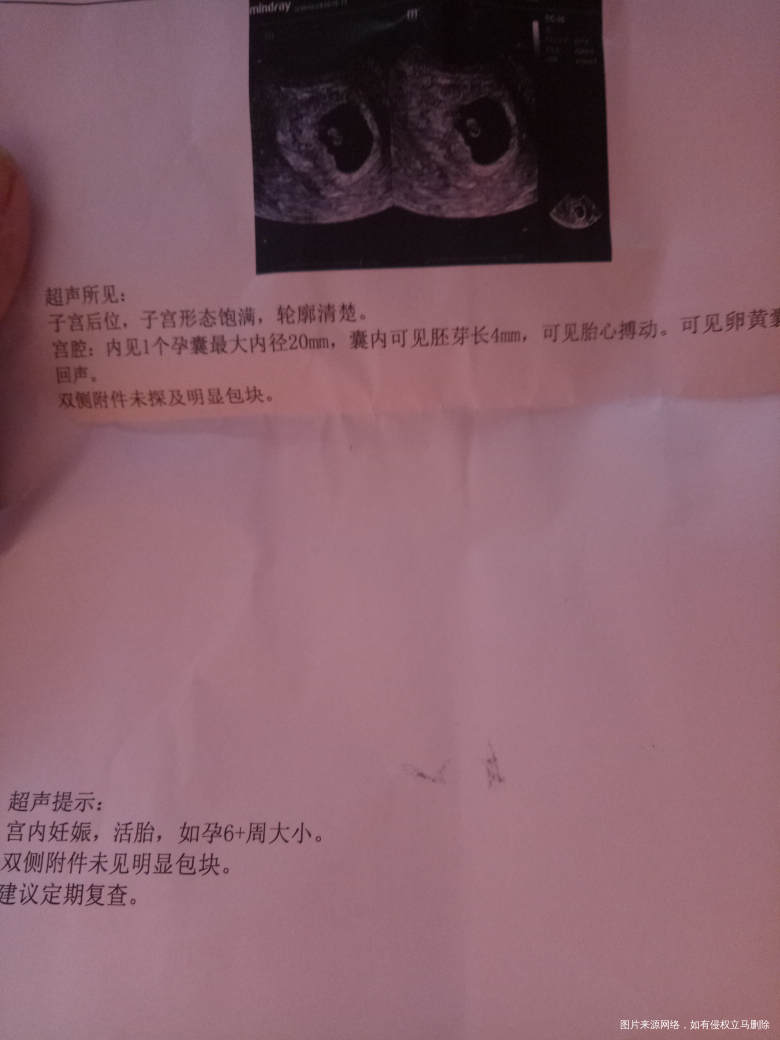 末次月经4.15。5.5号排卵。今天7+2