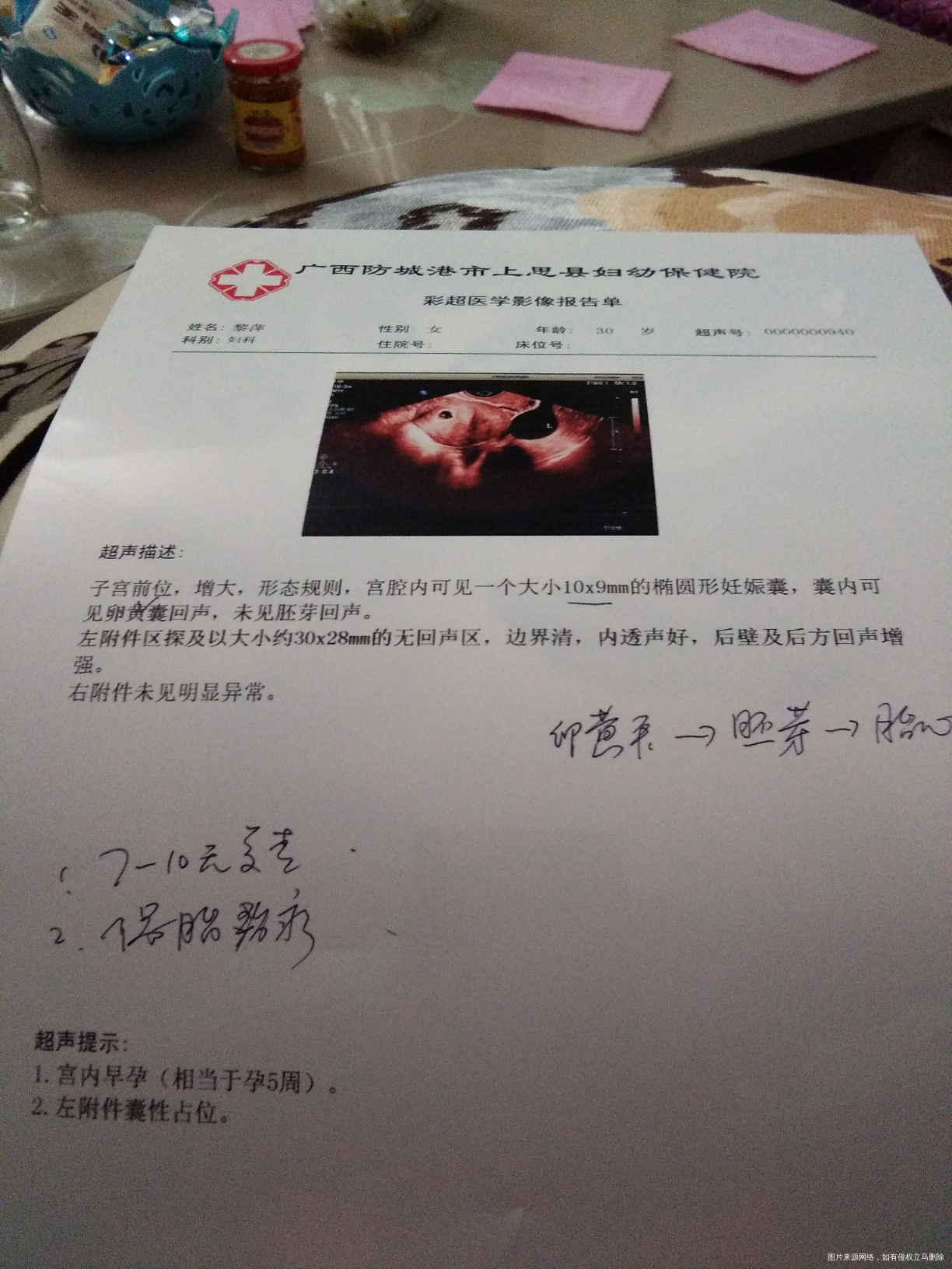 有一次过胎停,3月19号,hcg为280,孕酮28