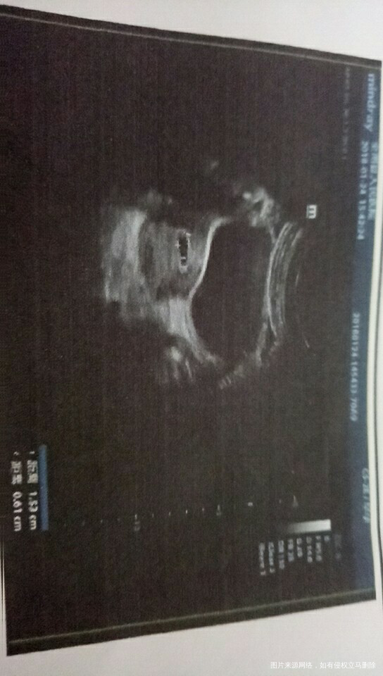 帮我看看,急急,谢谢了哈