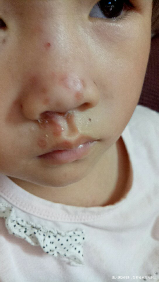 医生可以帮我看一下这个血液报告吗?