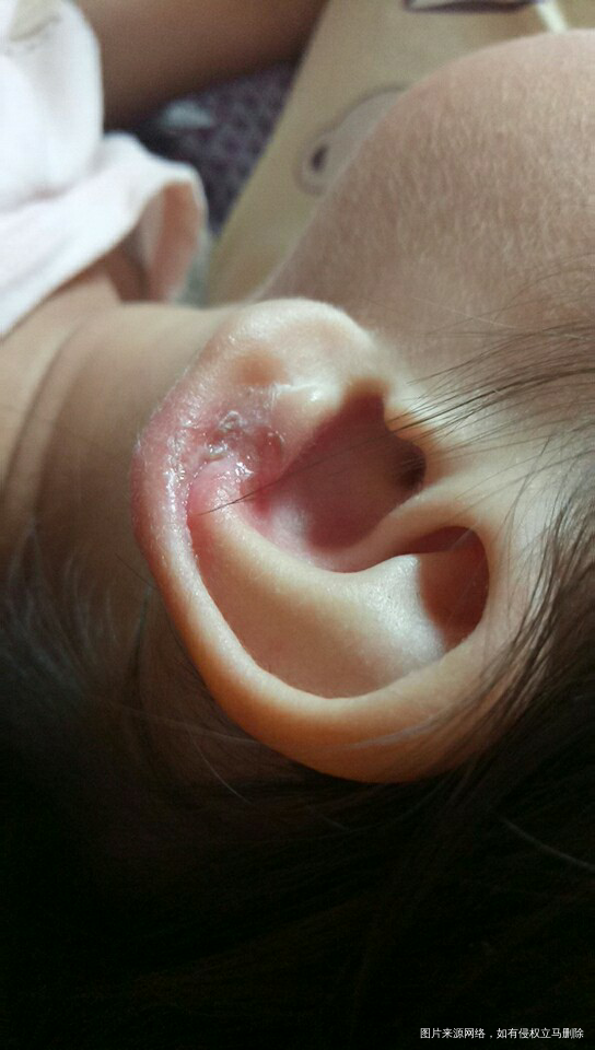 医生可以帮我看一下这个血液报告吗?