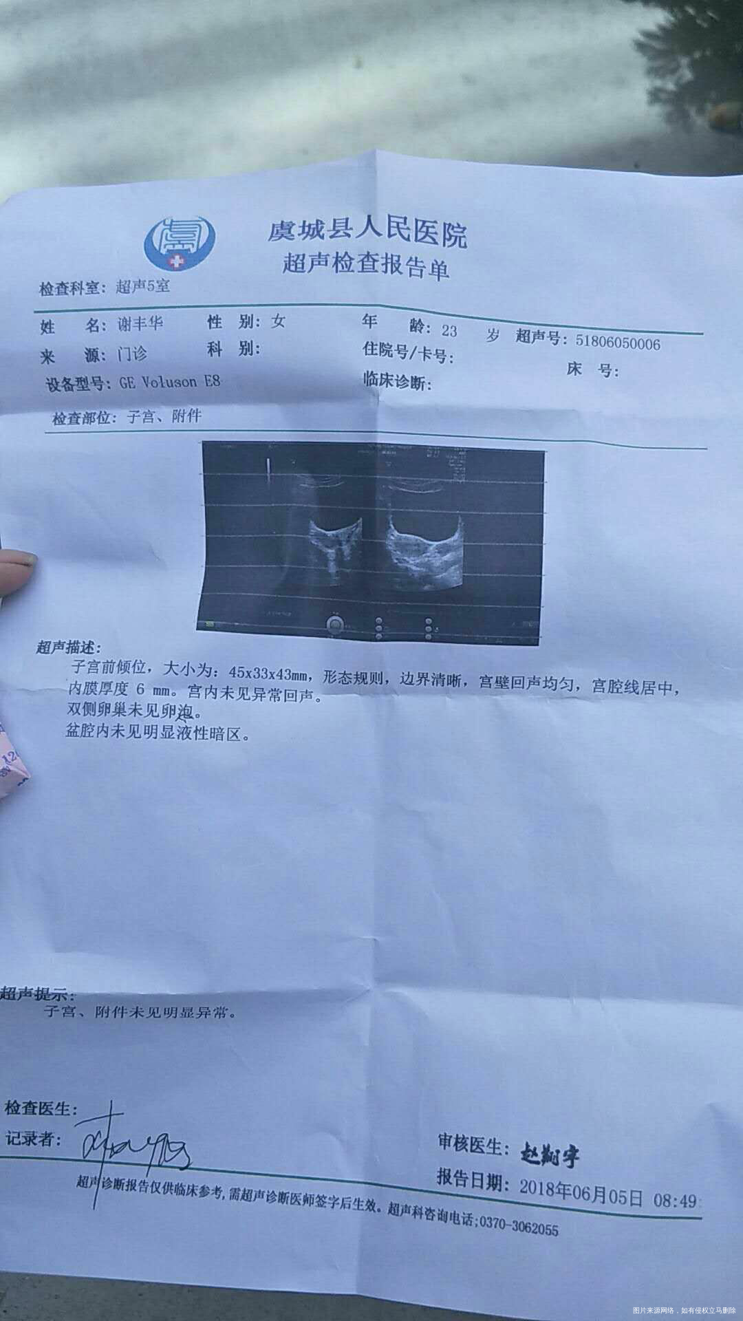 5.24号来月经,28号走