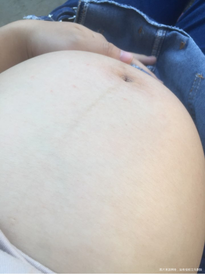 请医生帮我看一下要不要紧啊,急急急!