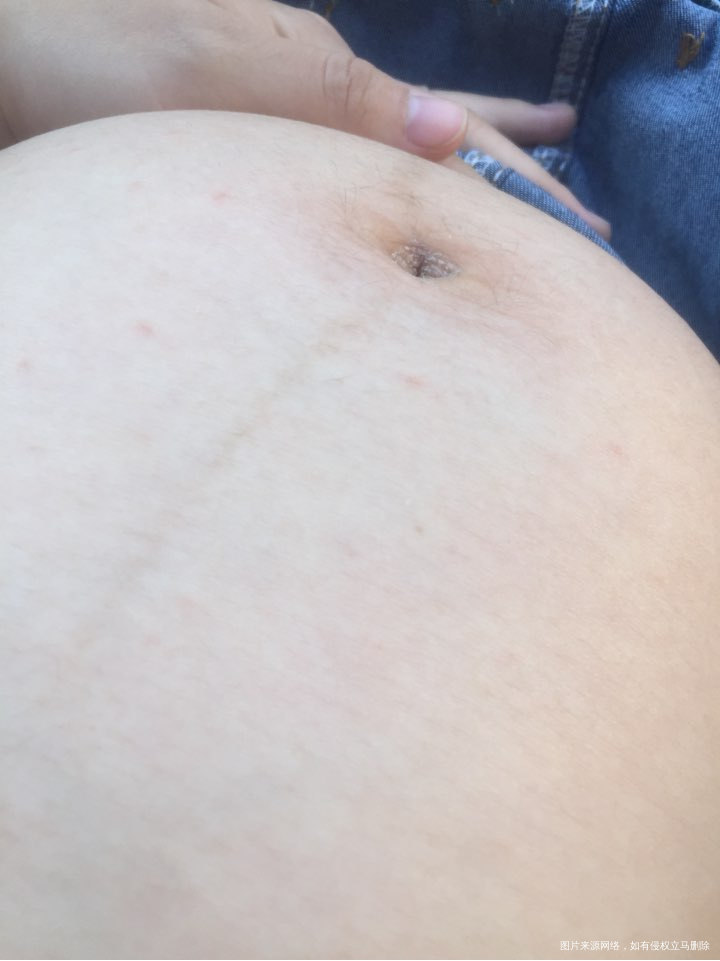 请医生帮我看一下要不要紧啊,急急急!