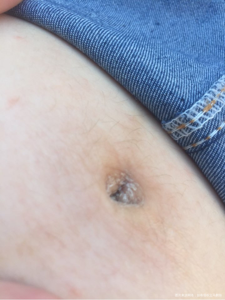 请医生帮我看一下要不要紧啊,急急急!