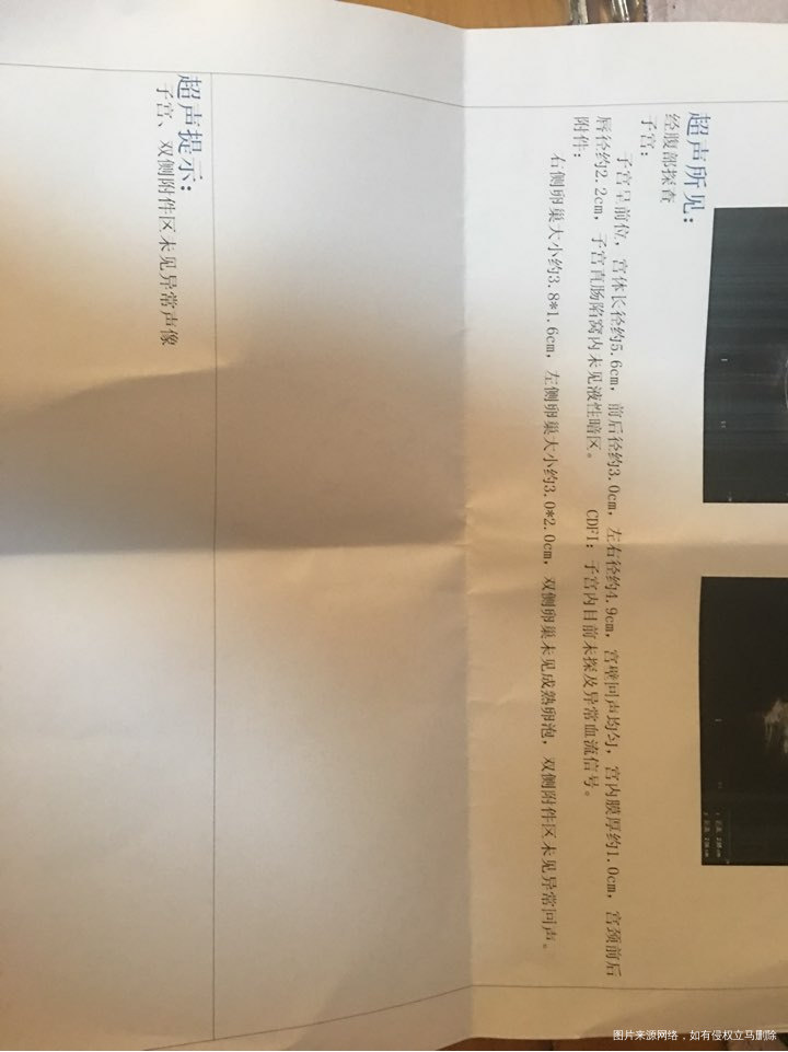 卵泡没有了,是不是就排出来了……