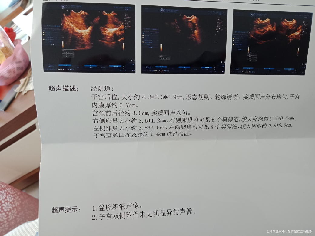 
有谁会看,帮忙看一下。