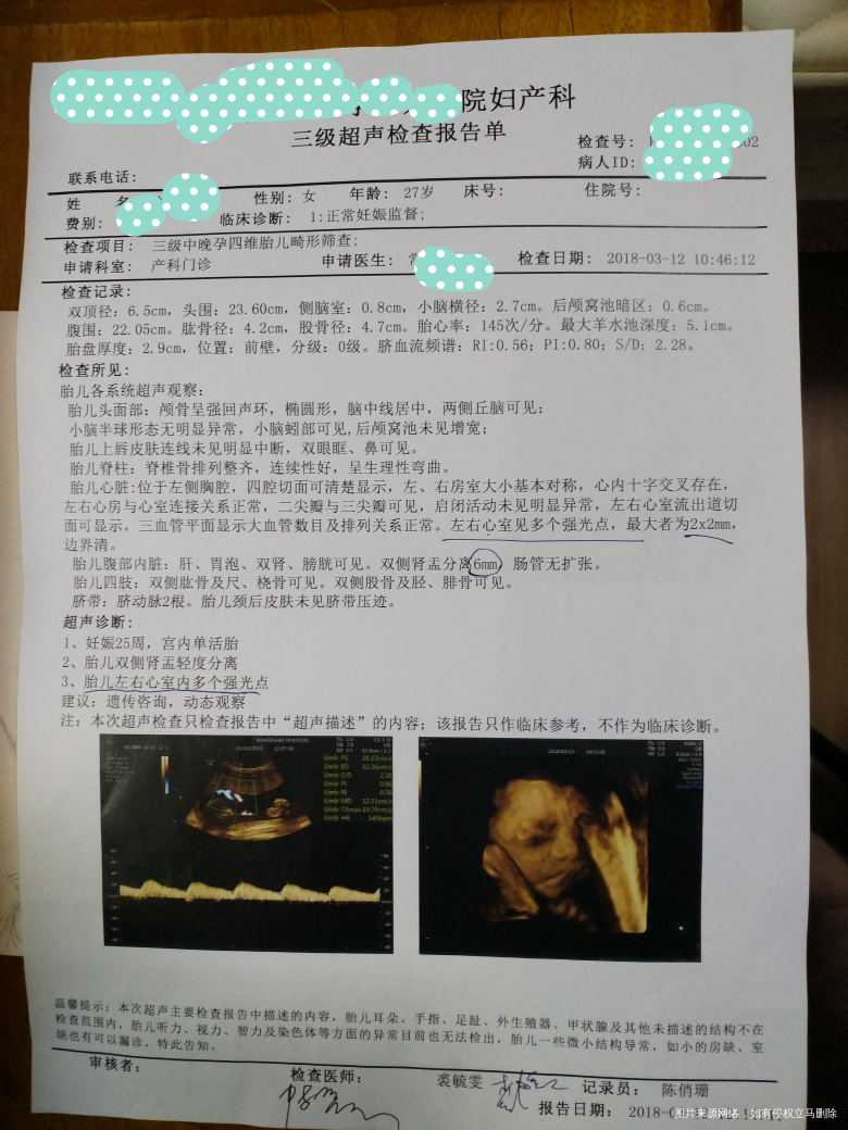 姐妹们,宝宝四维如下,麻烦点进来看看