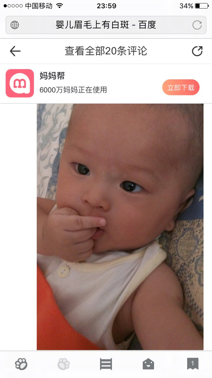 宝宝脸上有白斑,不知道是怎么回事?