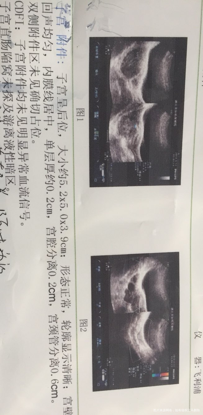 下次月经干净后还需要去复查B超吗?