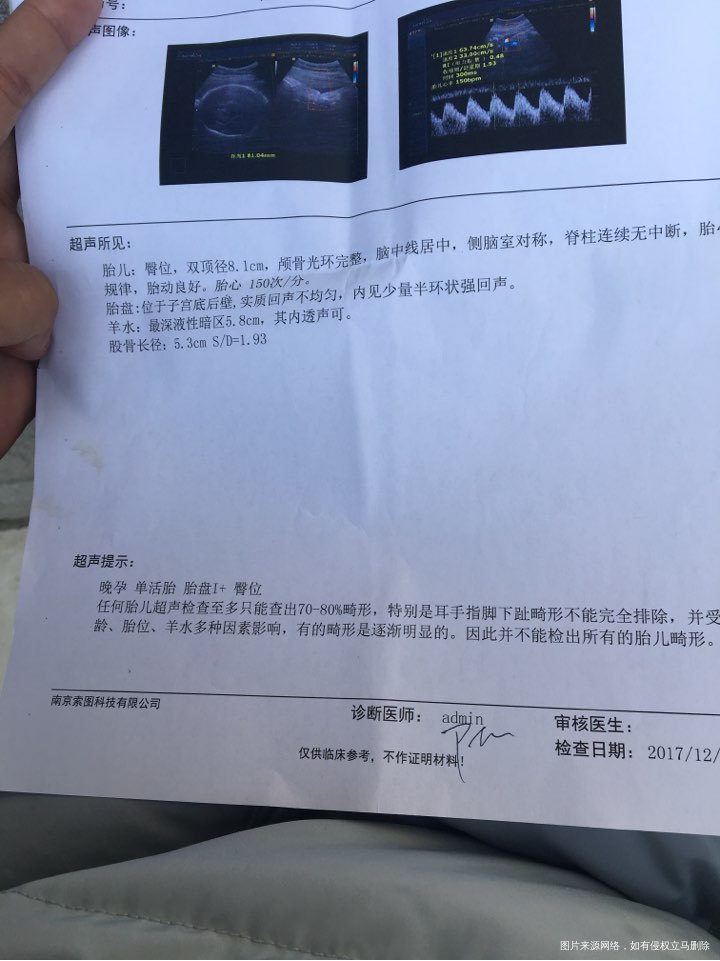 这是昨天的检查单,请医生帮我看看