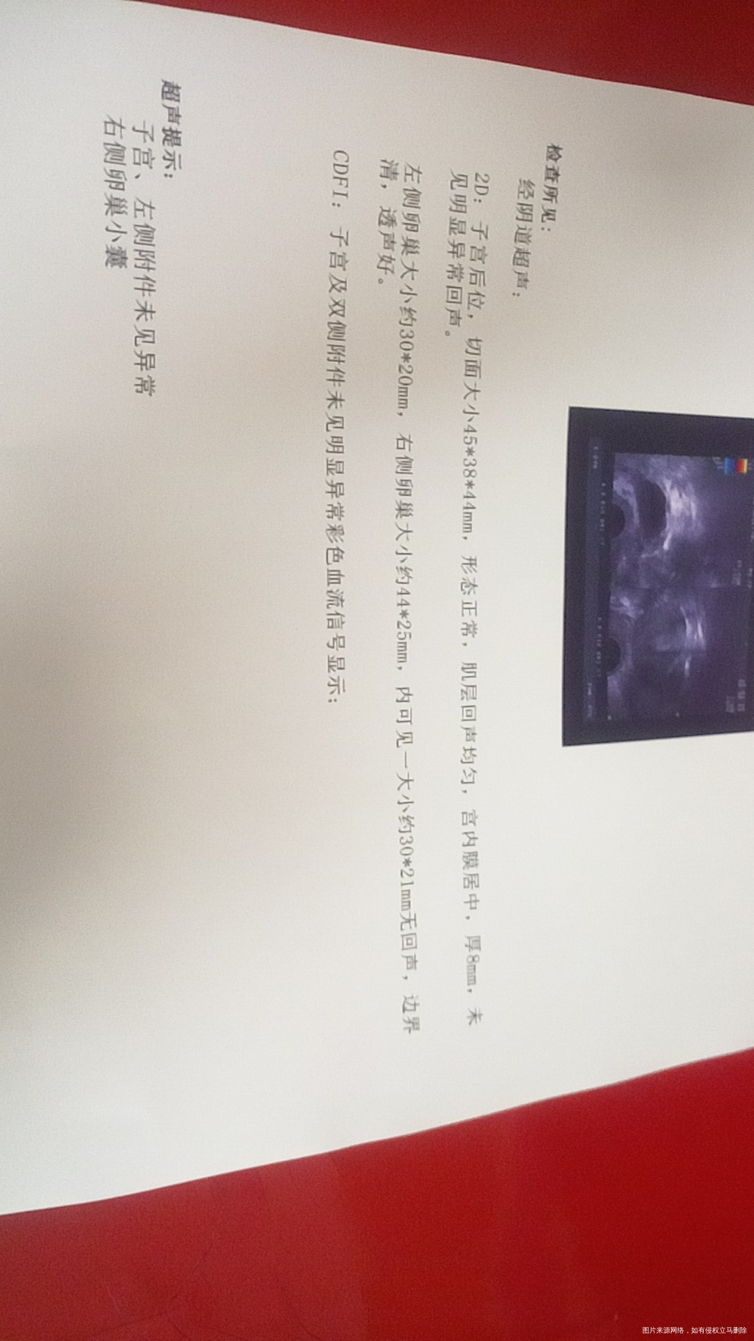 姐妹们谁的卵泡有这么大的吗?