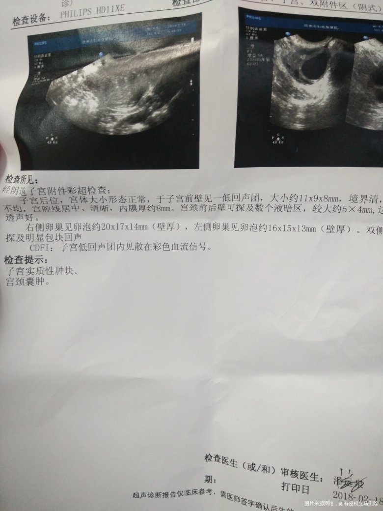 今天又去检测了,有可能排两个吗?