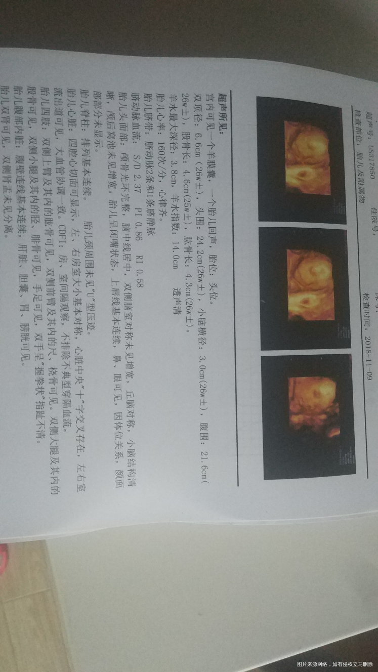 孕25周做四维后大夫让复查个心脏彩超