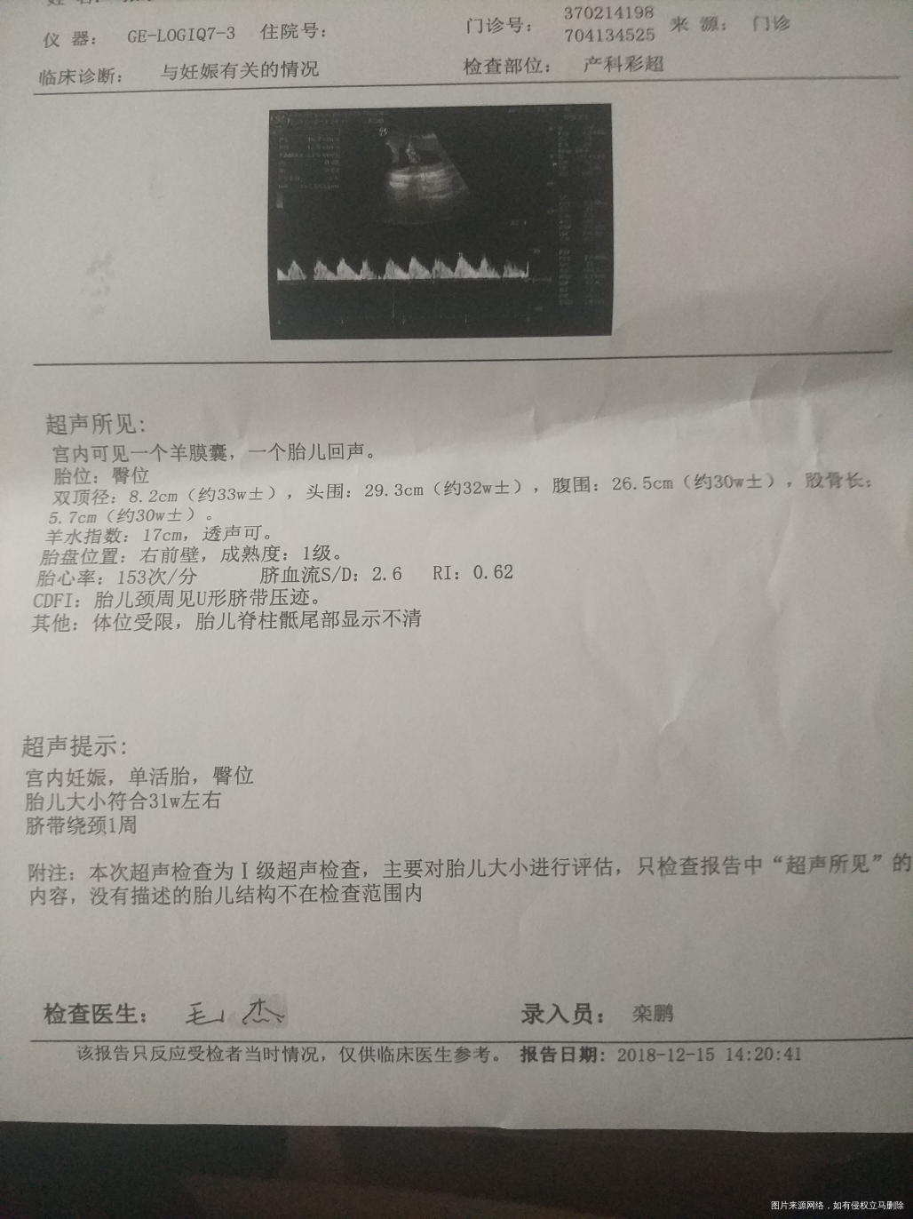 末次月经18年5月18号,今天产检做B超了,请帮忙看一下