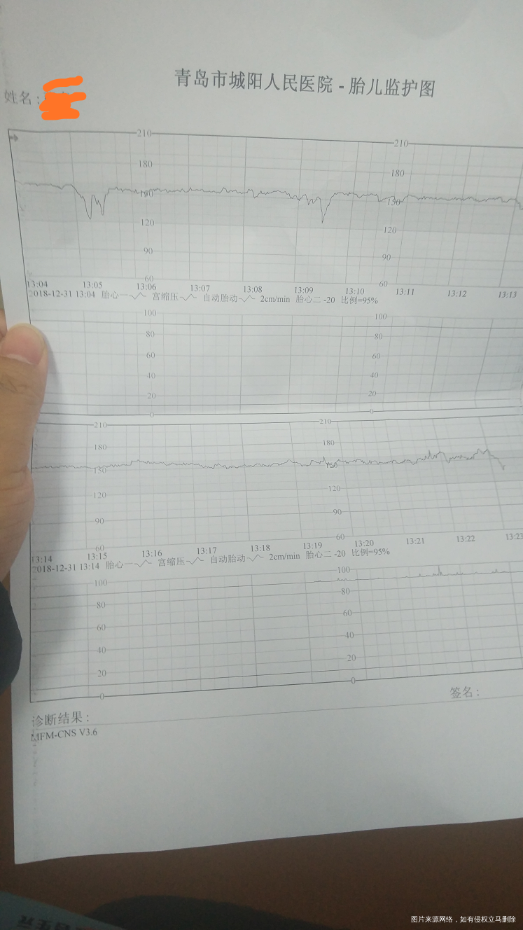 32周产检,帮忙看一下