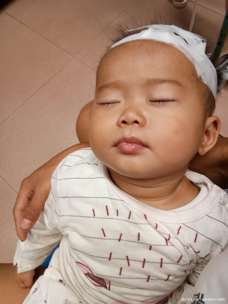心疼π_π闺女,居然有手足口病