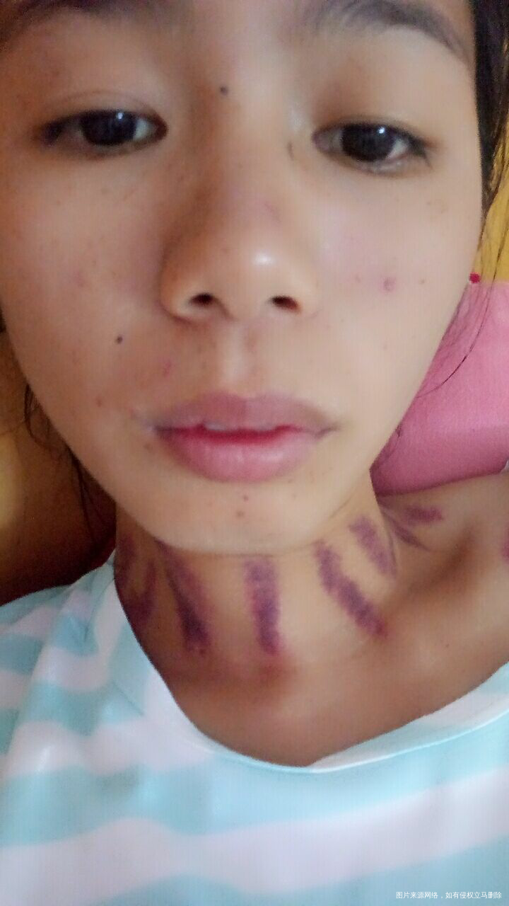 【生活感悟】在我生病的时候感受到老公和婆婆对我的好