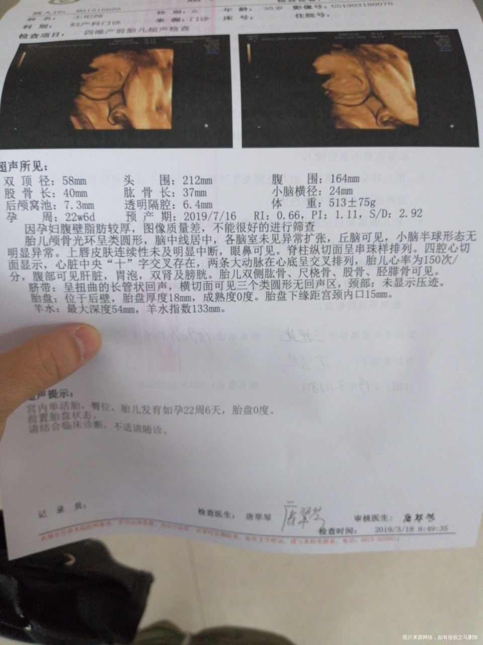 #我的每一次产检#+二胎四维一次通过