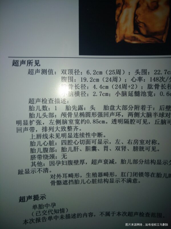 有情况相同的姐妹吗?求解答