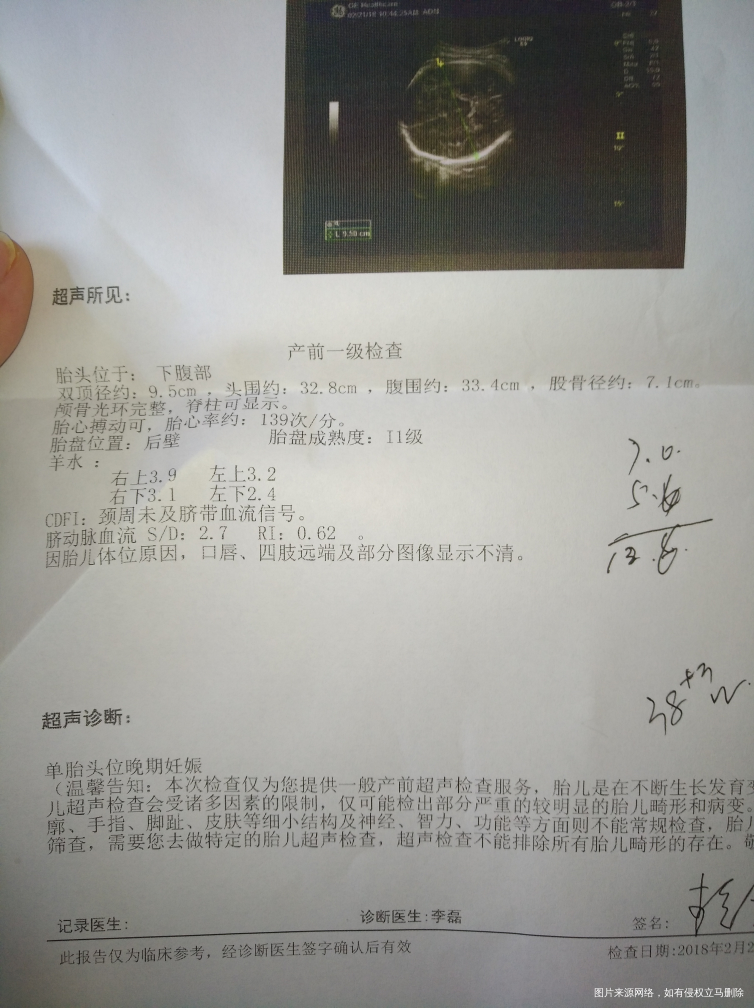 医生帮忙看看,求解答,怀孕38周+3