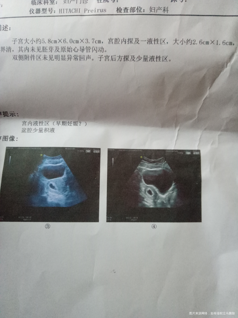 急急急,求在线医生帮忙看看,谢谢