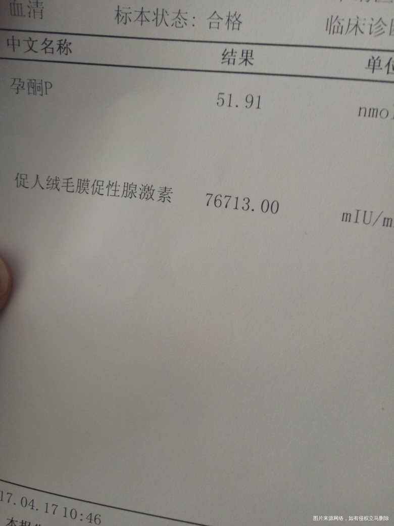 急急急,求在线医生帮忙看看,谢谢