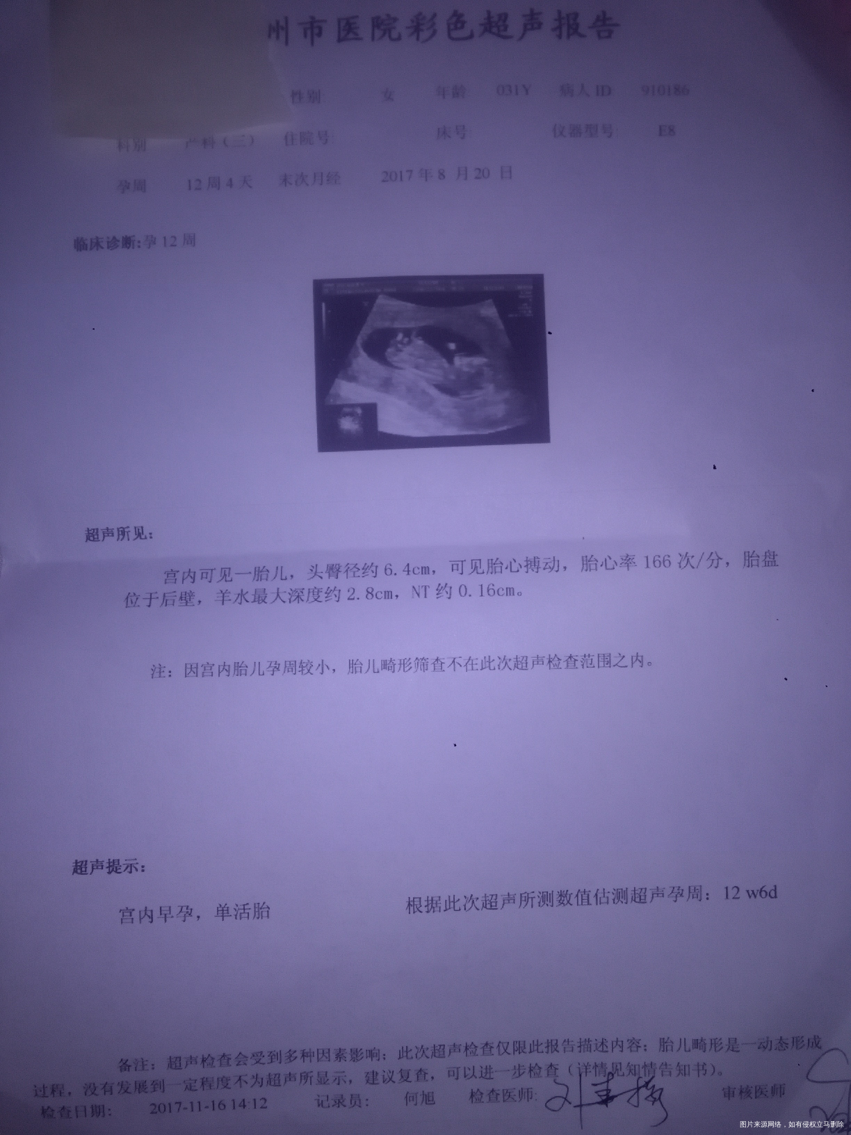 今天去医院检查了,就是早晨吃饭了没有查血,B超宝宝一切都正常,还要比实际天数大两...