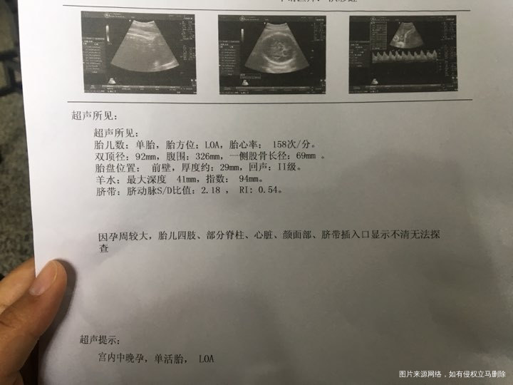 医生,帮我看下入盆了吗?