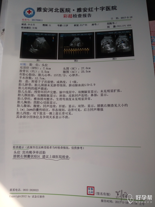 2017-05-18 10:47:58 咨询医生 你好,有可能是胎儿肠管回声,可以