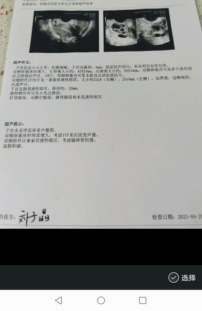 双侧输卵管堵塞取完卵后B超显示25*8积液严重吗?