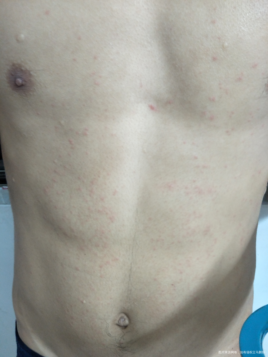 求助医生,医生医生请帮忙看看