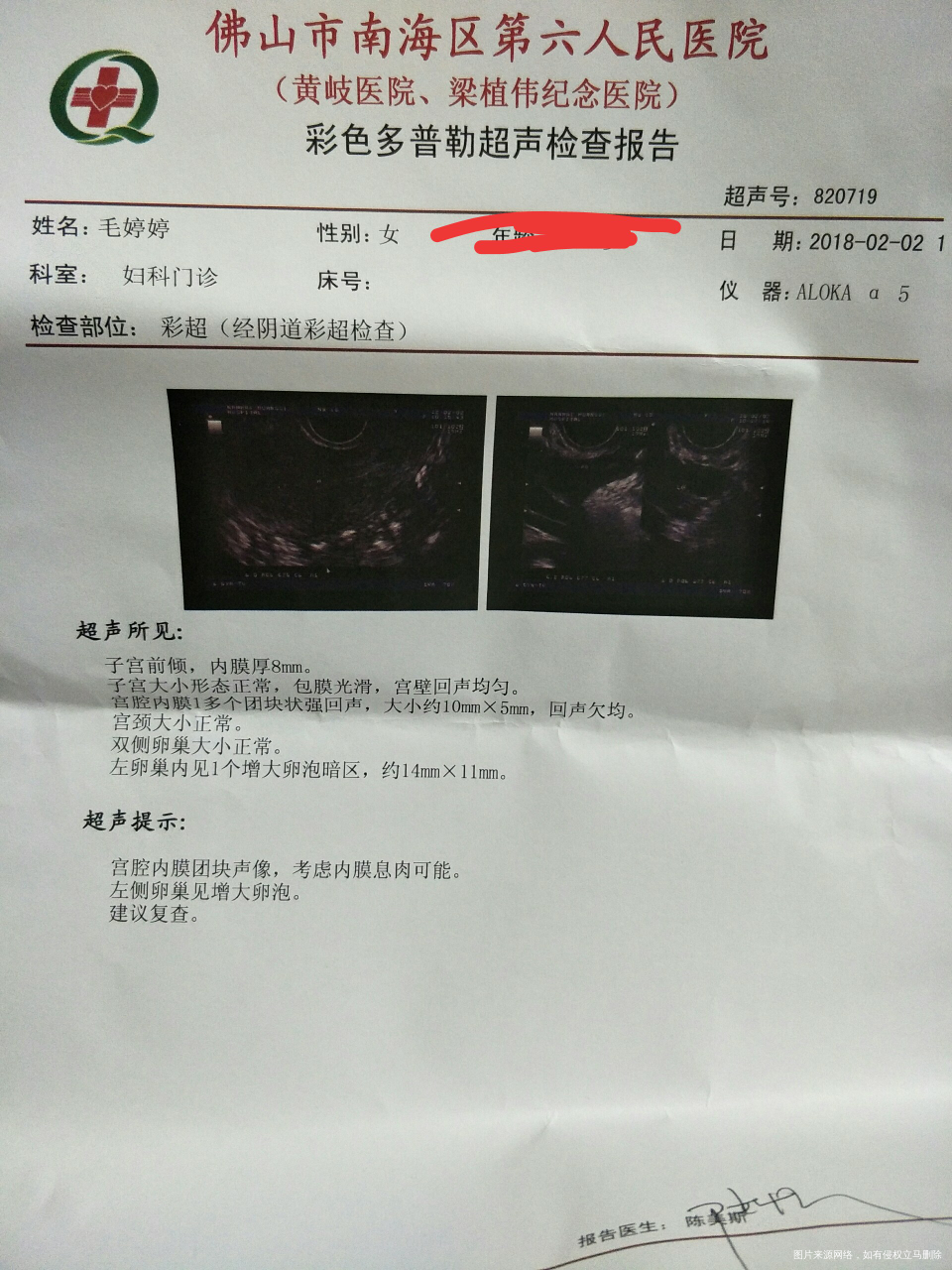 今天做了检查,医生帮看看,