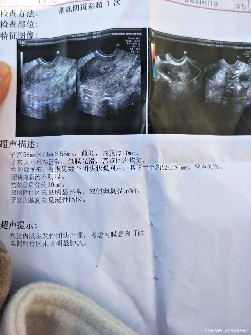 查出子宫有息肉,我25岁,没怀过孕