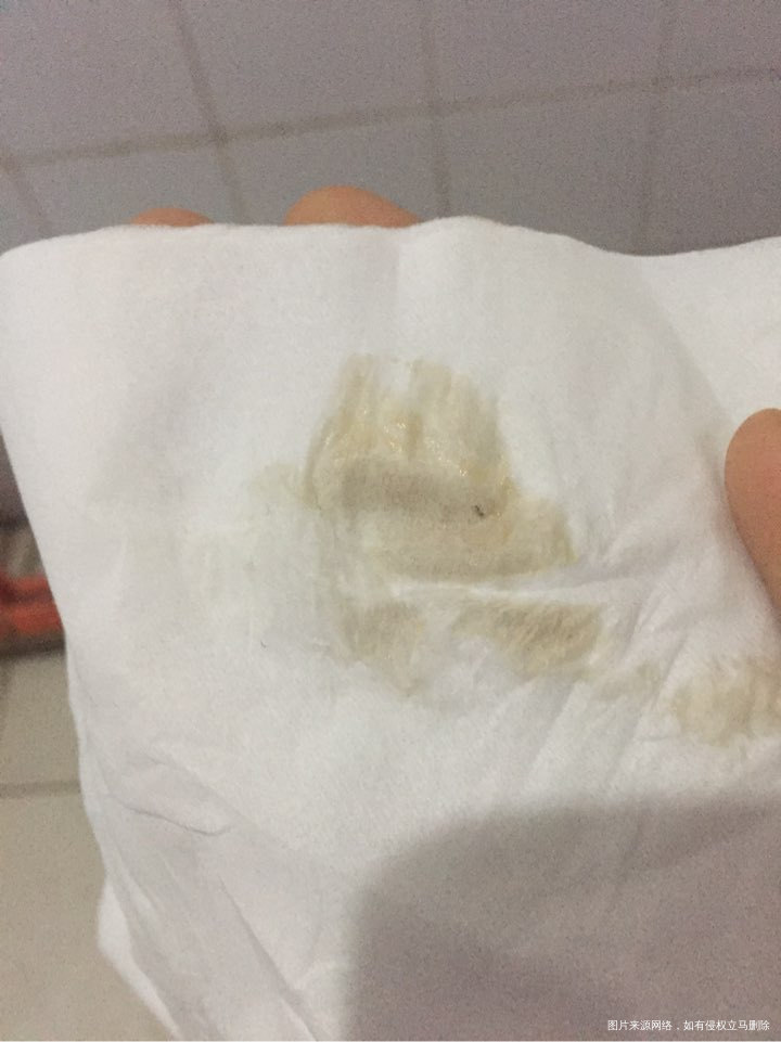 早孕 45天 求助 求助 求助